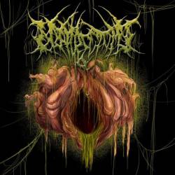 Nephrectomy : Promo 2012